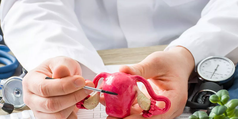 درمان سرطان آندومتریوز رحم با رادیوتراپی