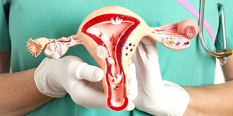 درمان سرطان دهانه رحم با رادیوتراپی