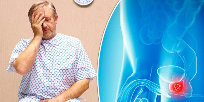 بهترین دکتر درمان سرطان پروستات